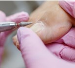 הסרת יבלות? סידור ציפורניים? פדיקור? פודו-פדיקור! -תמונה